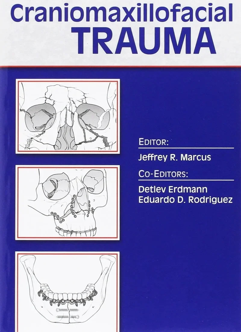 Essentials of Craniomaxillofacial Trauma (Original PDF from Publisher)