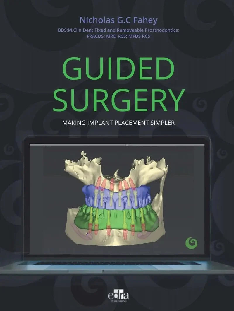 GUIDED SURGERY: Making implant placement simpler (Original PDF from Publisher)