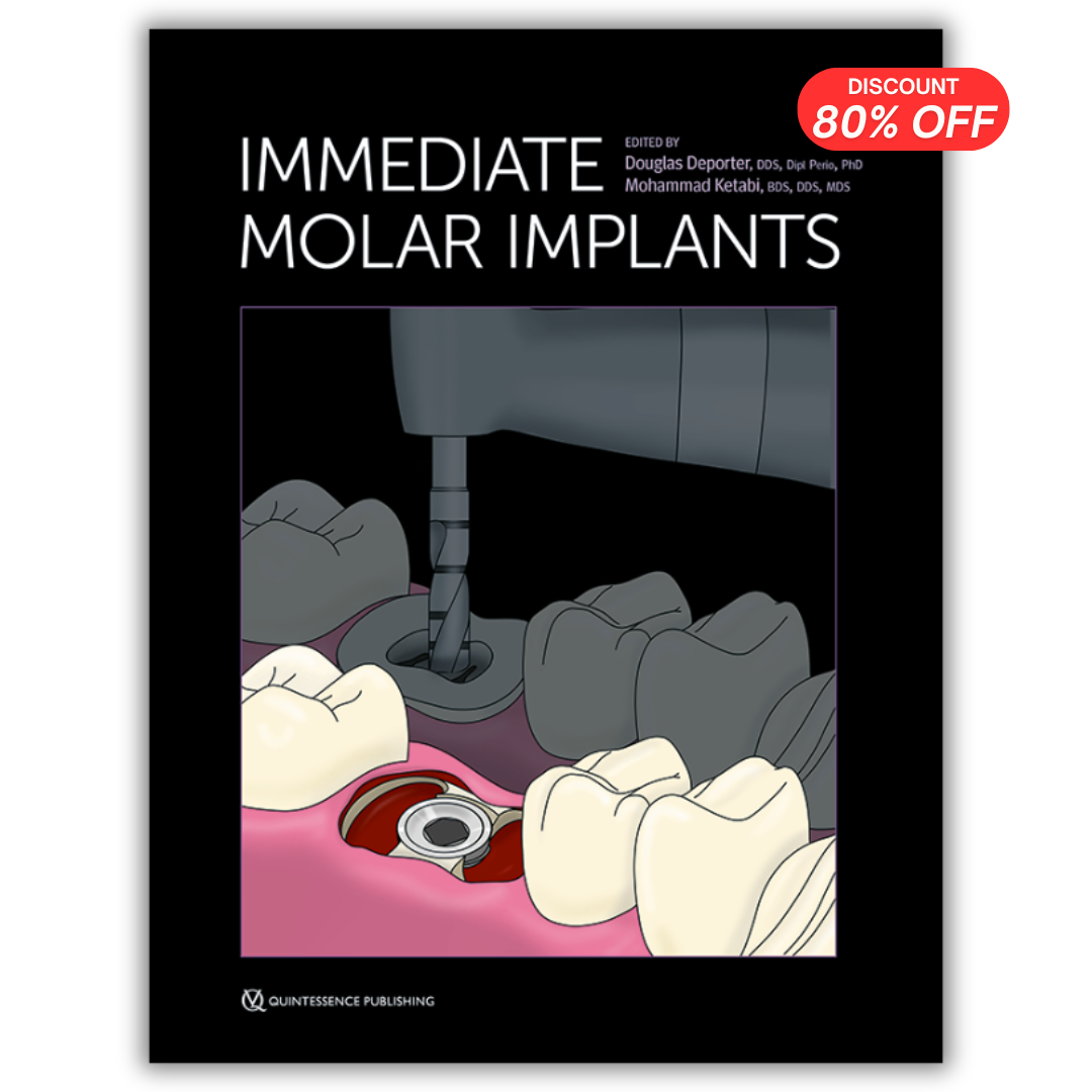 Immediate Molar Implants (PDF)