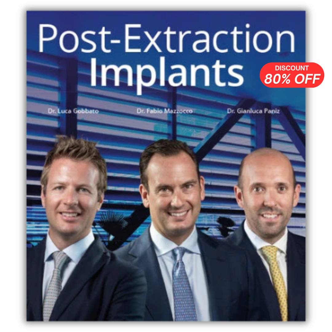 Post-Extraction Implants (Video course)