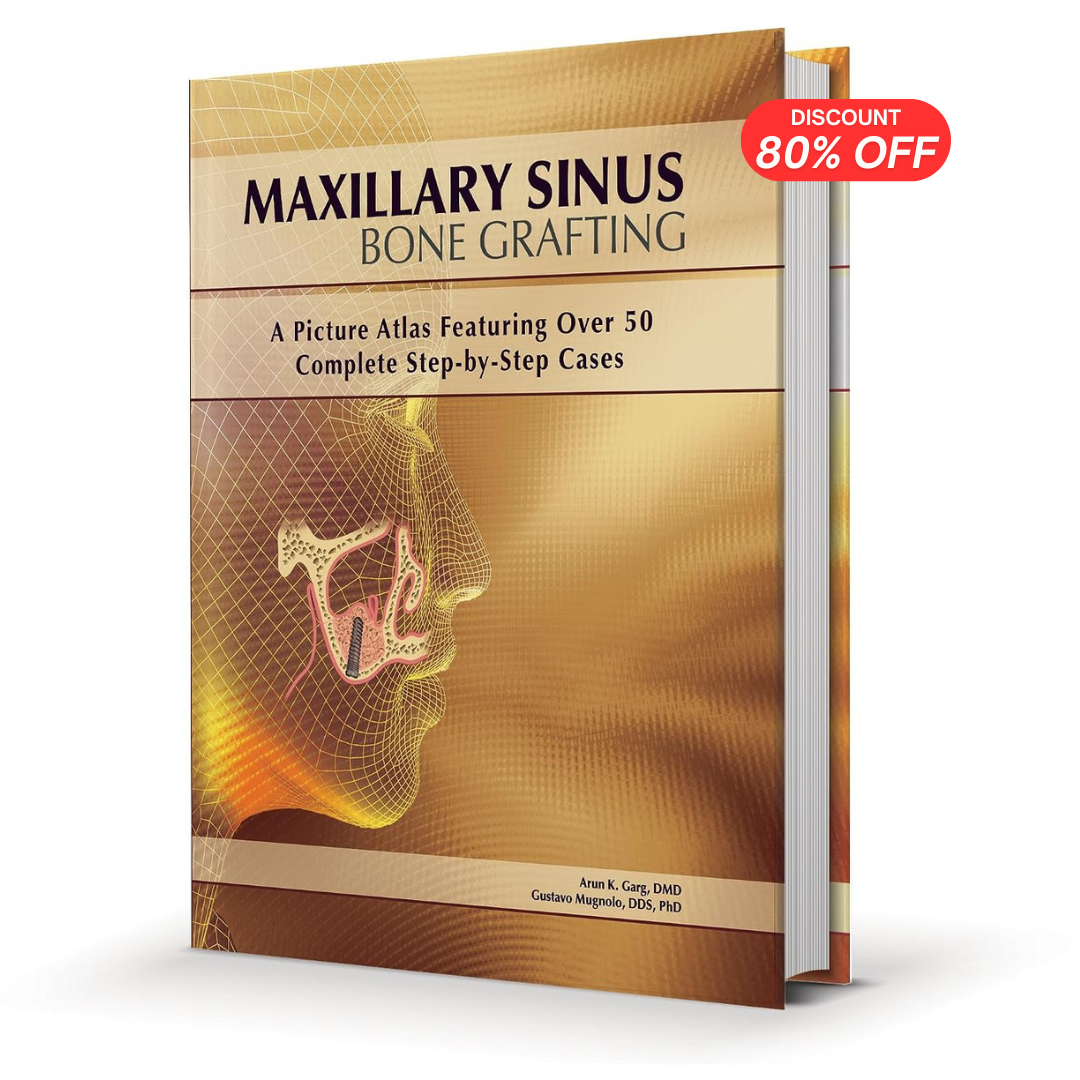 Maxillary Sinus Bone Grafting (PDF)