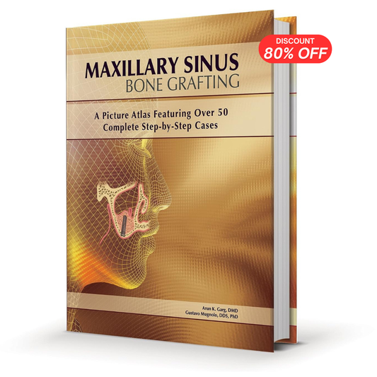 Maxillary Sinus Bone Grafting (PDF)