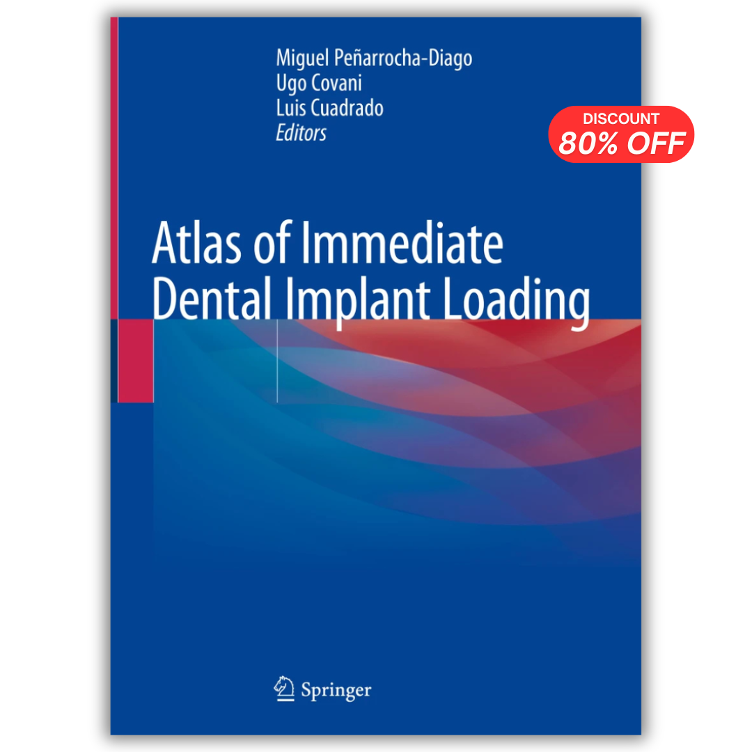 Atlas Of Immediate Dental Implant Loading (PDF)