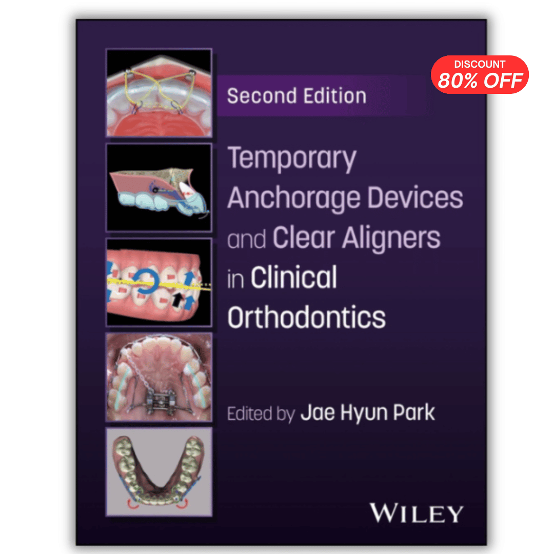 Temporary Anchorage Devices and Clear Aligners in Clinical Orthodontics  (PDF)