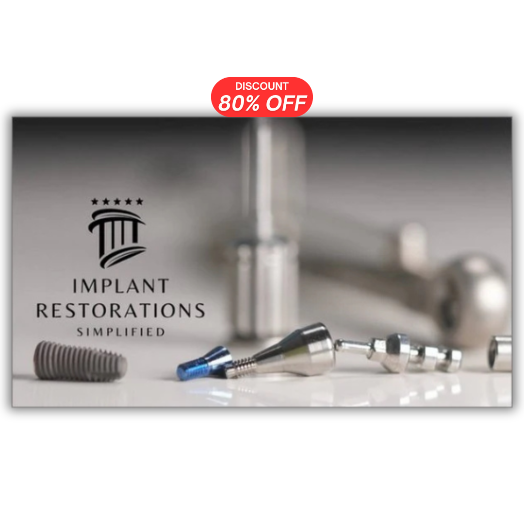 Implant Restorations Simplified: Restore Dental Implants with Accuracy & Confidence (Surgical Master)