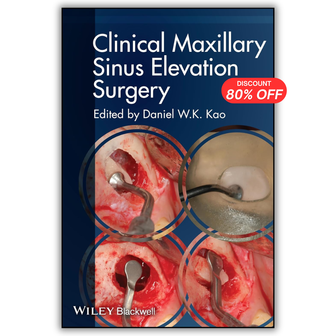 Clinical Maxillary Sinus Elevation Surgery (PDF)
