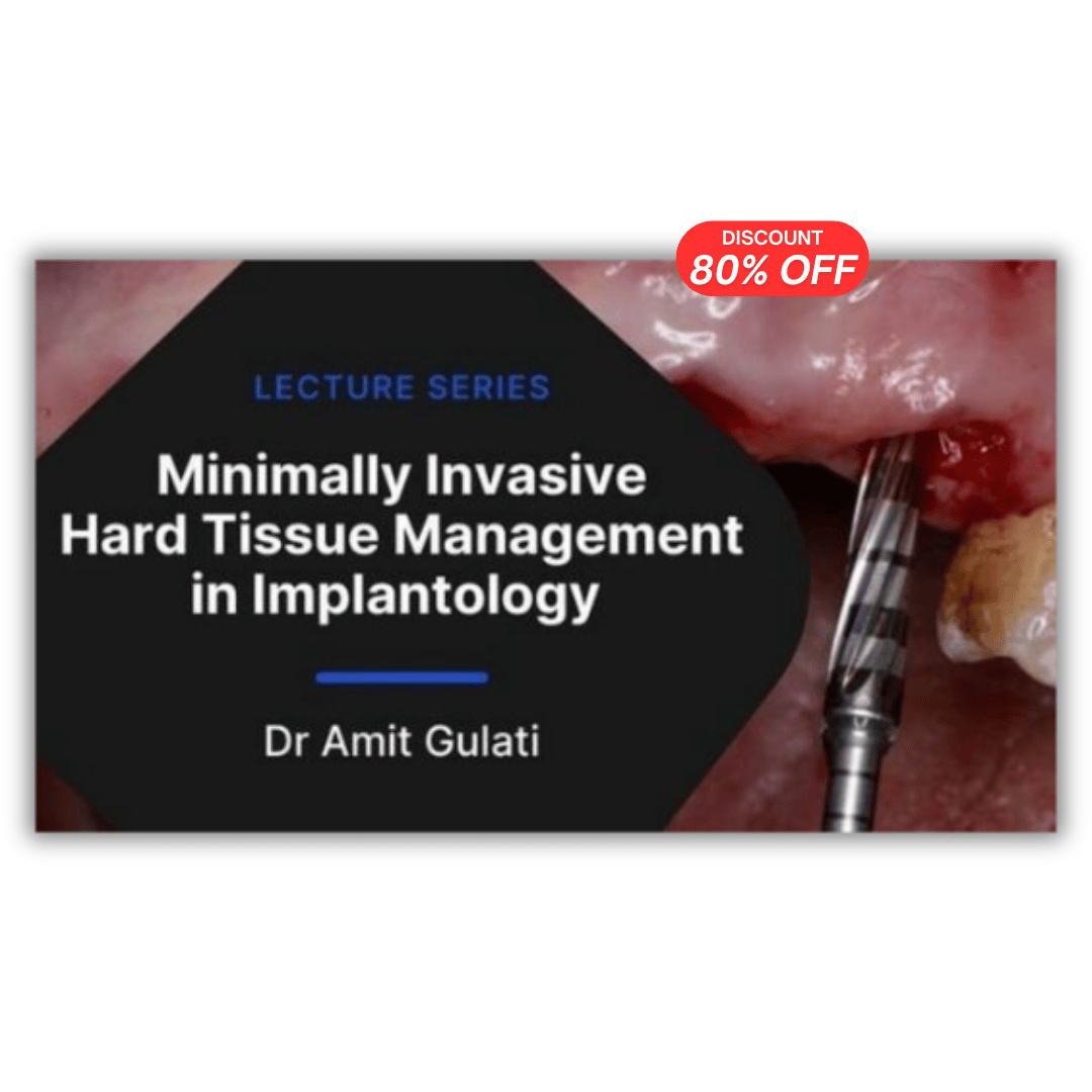 Minimally Invasive Hard Tissue Management in Implantology (2 Lectures)