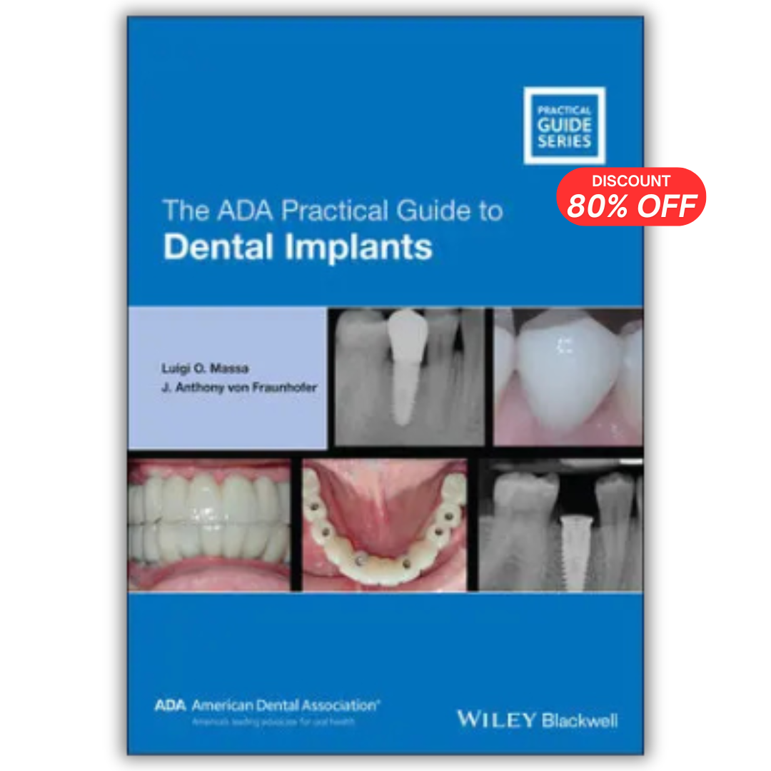 The ADA Practical Guide to Dental Implants