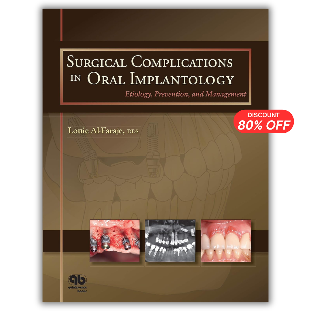 Surgical Complications in Oral Implantology: Etiology, Prevention, and Management (PDF)