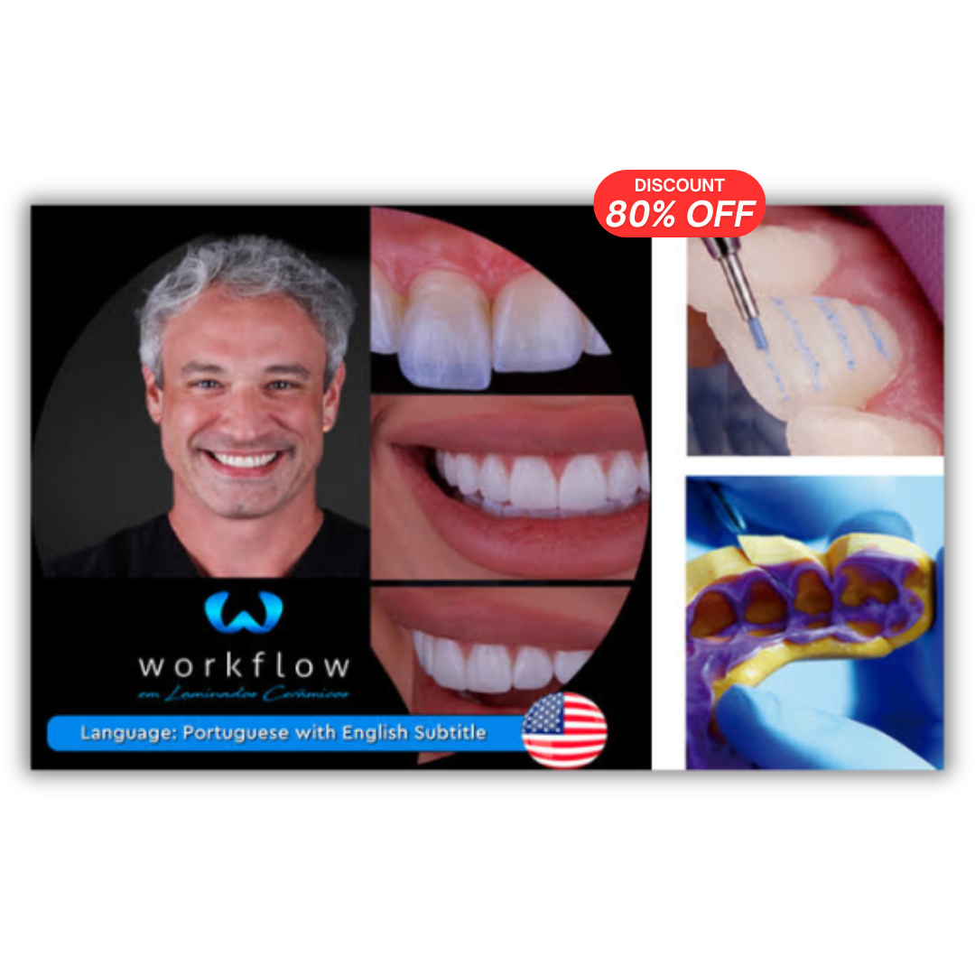 Ceramic Veneers Workflow