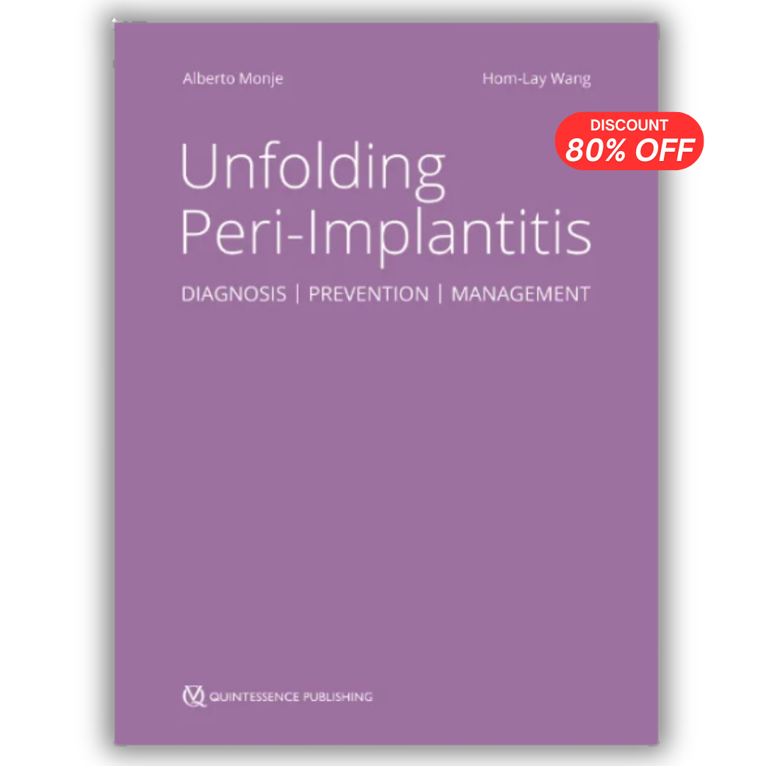Unfolding Peri-Implantitis: Diagnosis, Prevention, Management – 2nd Edition