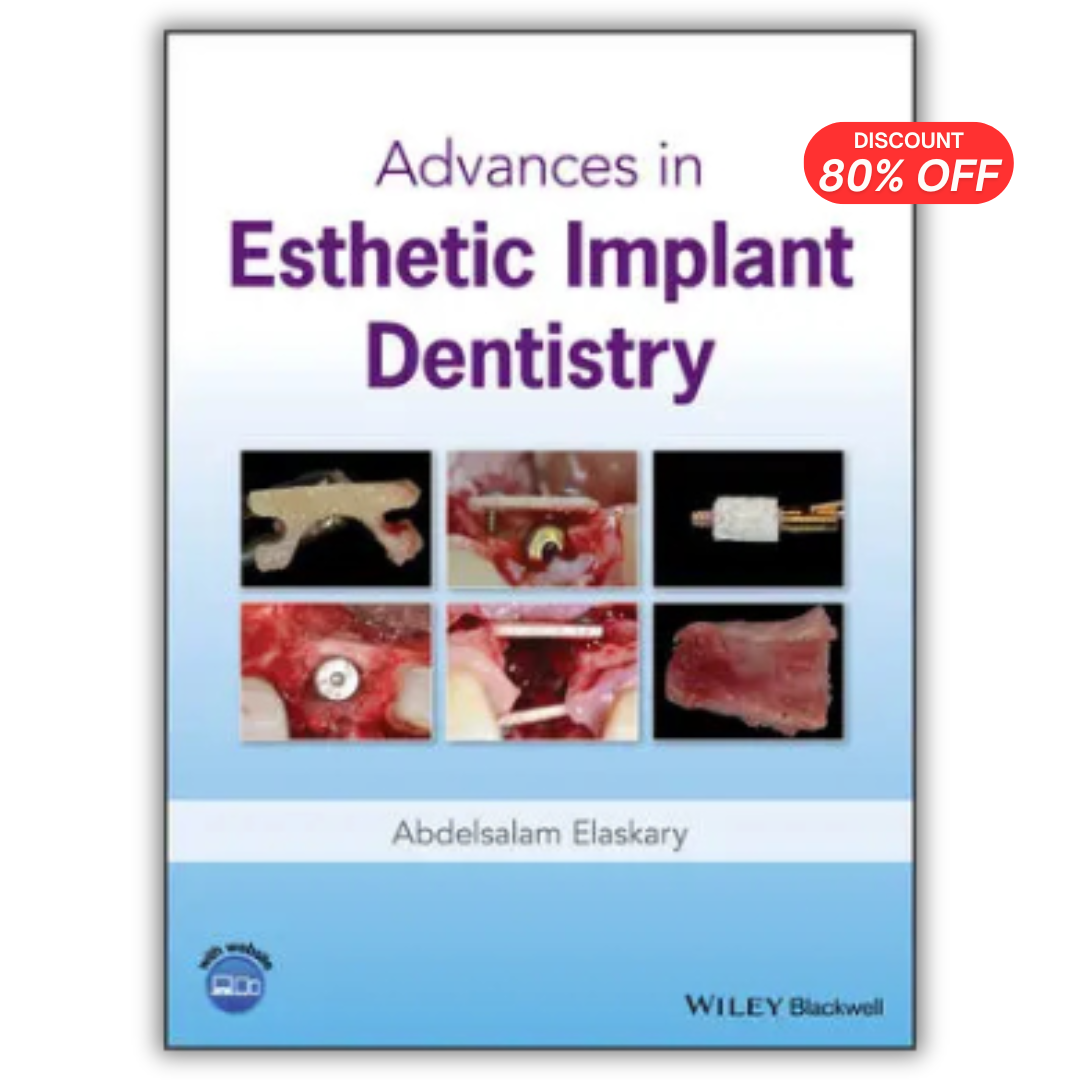 Advances in Esthetic Implant Dentistry (PDF)