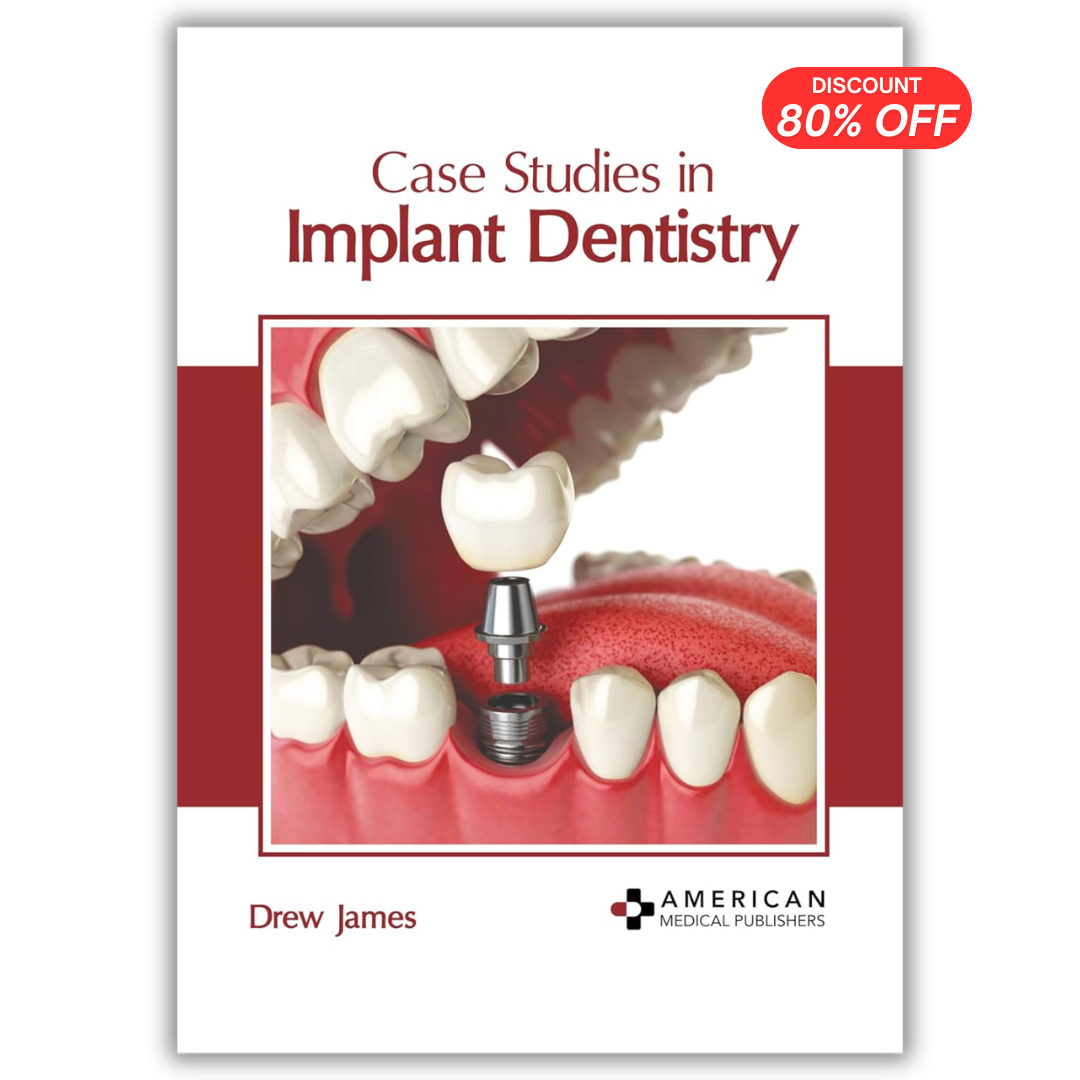 Case Studies in Implant Dentistry