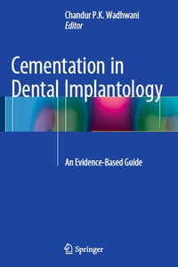 Cementation in Dental Implantology: An Evidence-Based Guide