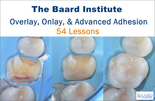 Overlay, Onlay, and Advanced Adhesion