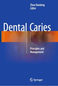 Dental Caries: Principles and Management